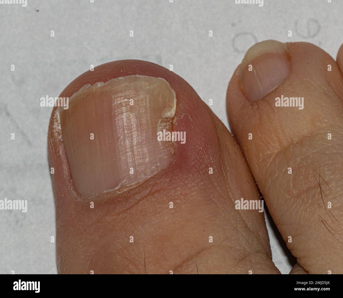 Close-up view of toes showing detailed texture and healthy nails Stock Photo