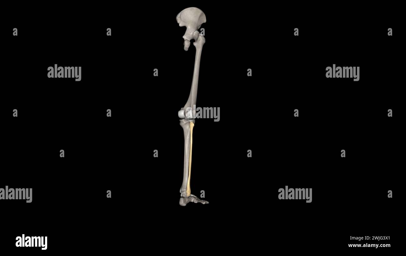 The fibula is a long bone in the lower extremity that is positioned on ...