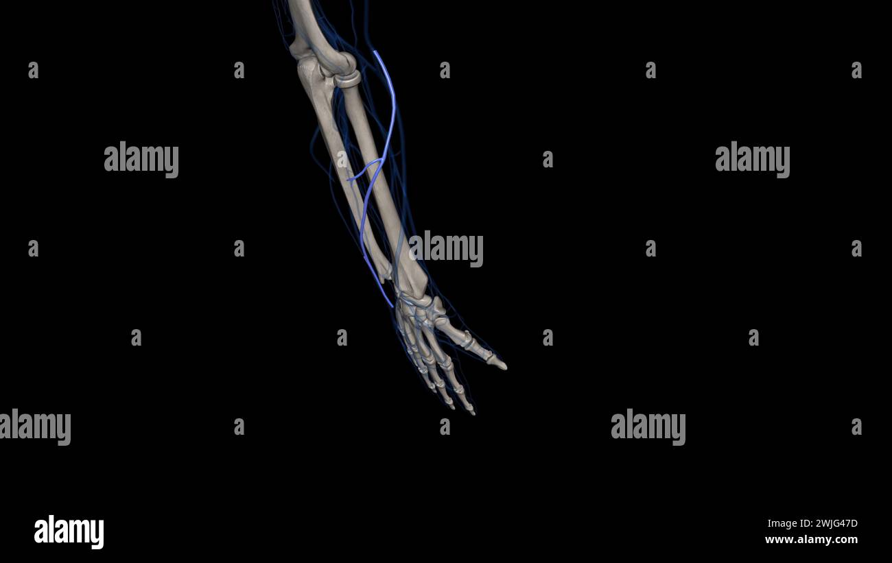 The accessory cephalic vein is the name for a variable vein that travels alongside the forearms radial or thumb-side border 3d illustration Stock Photo