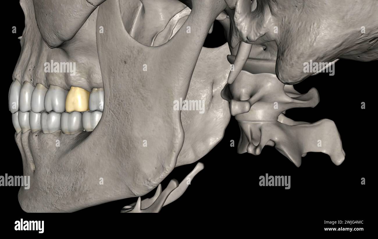 The maxillary second molar is the tooth located distally from both the ...