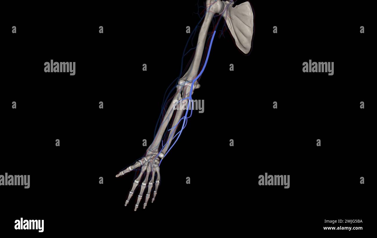 The basilic vein is a large superficial vein of the upper limb that