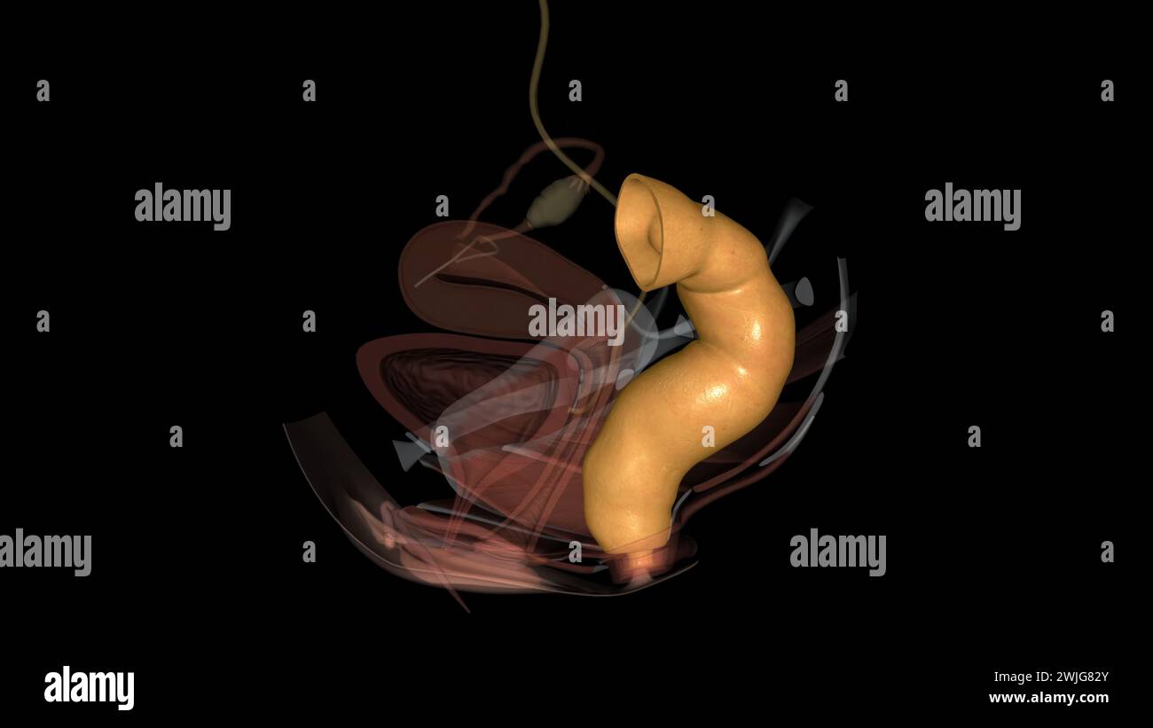 rectum is at the end of your colon and on the other side of your anal canal 3d illustration Stock Photo