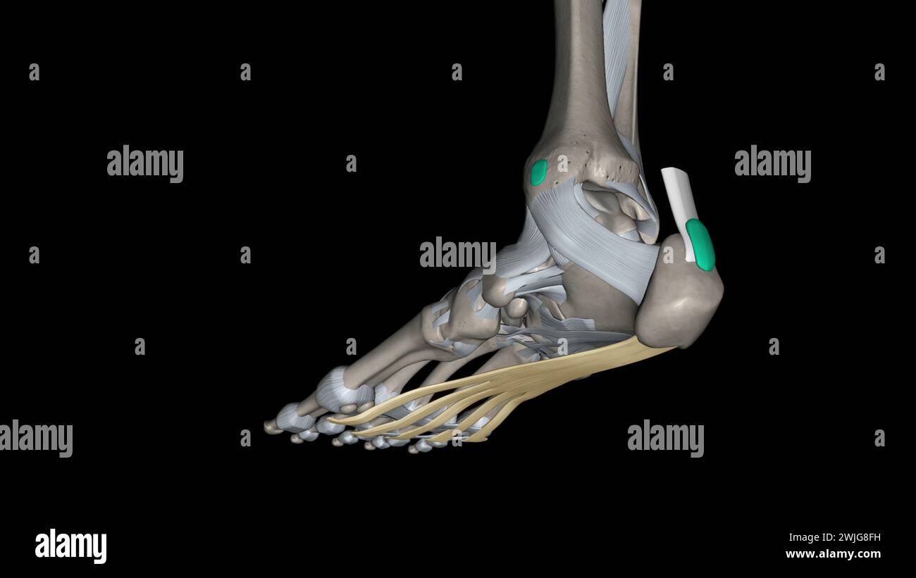 The Plantar aponeurosis is the modification of Deep fascia, which