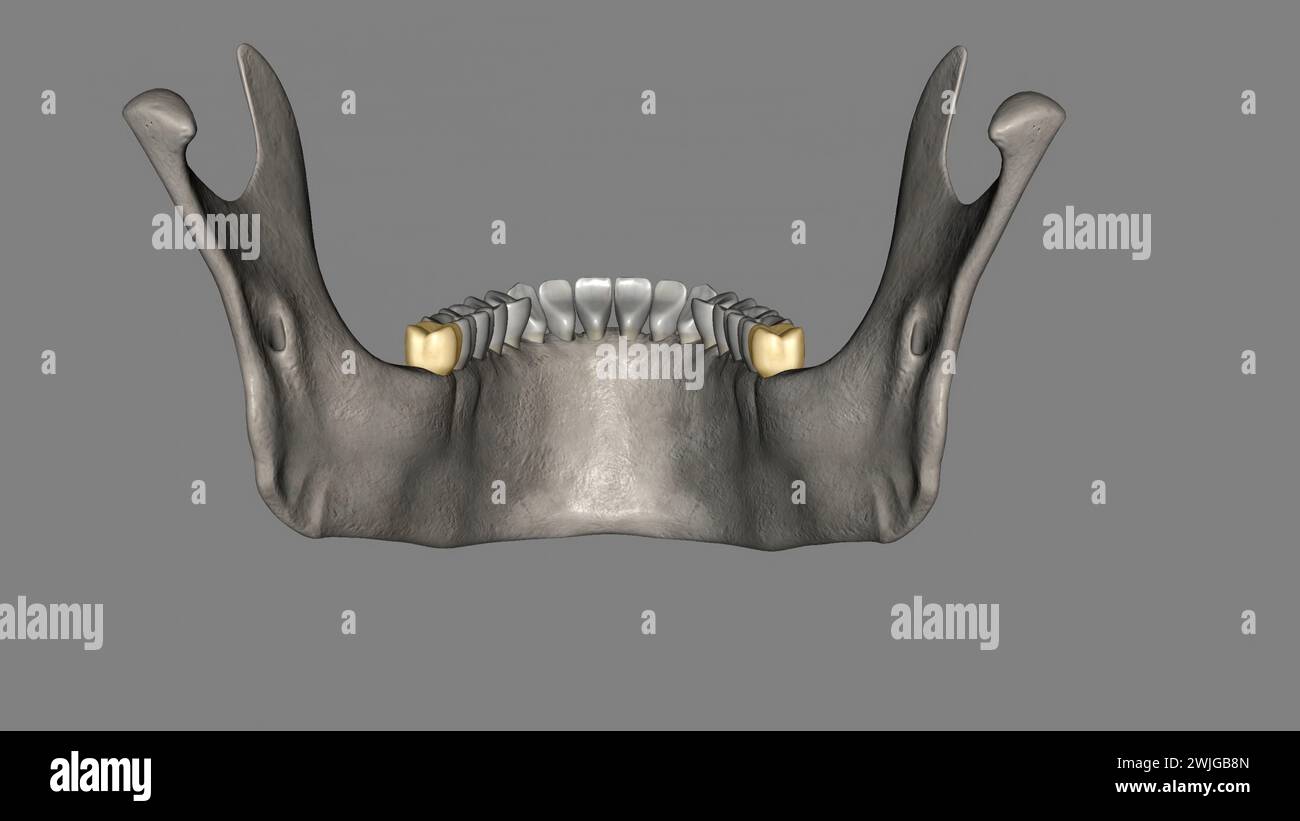 The mandibular third molar is also referred as the wisdom tooth 3d