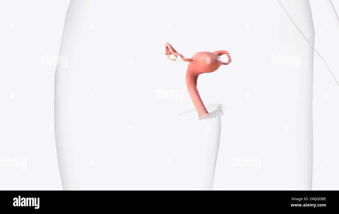 Female Internal Genital Organs Vagina Uterus and cervix Fallopian tubes  3d illustration Stock Photo