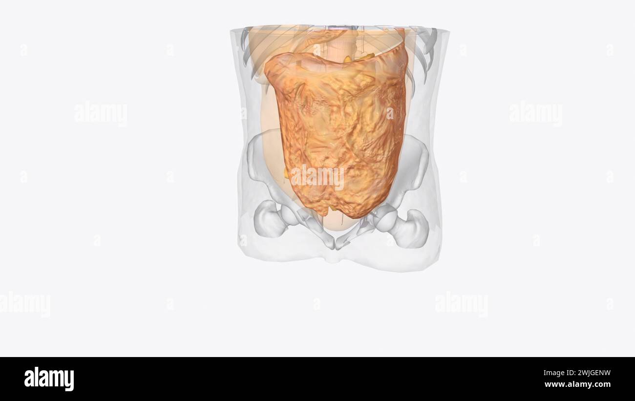 Connective tissue in vessels hi-res stock photography and images - Alamy
