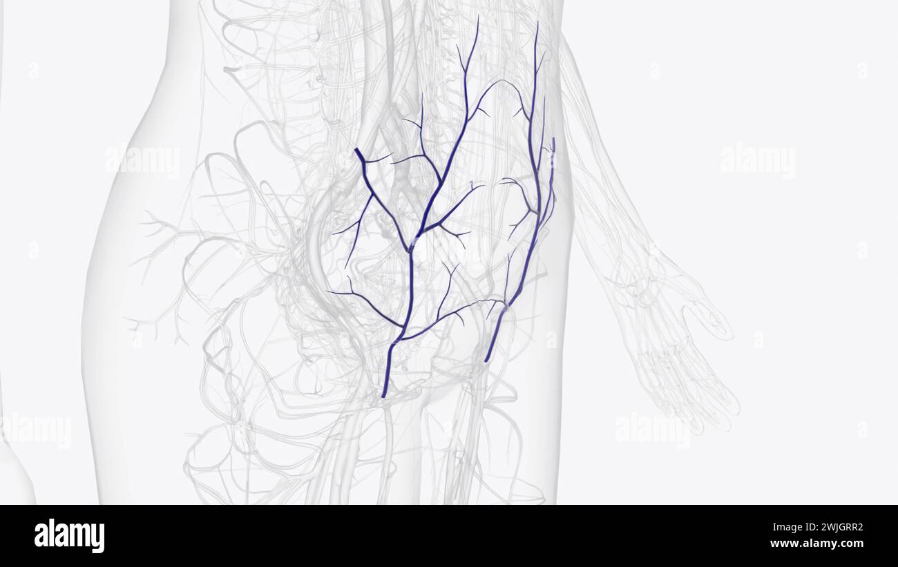 The superficial epigastric vein is a vein which travels with the