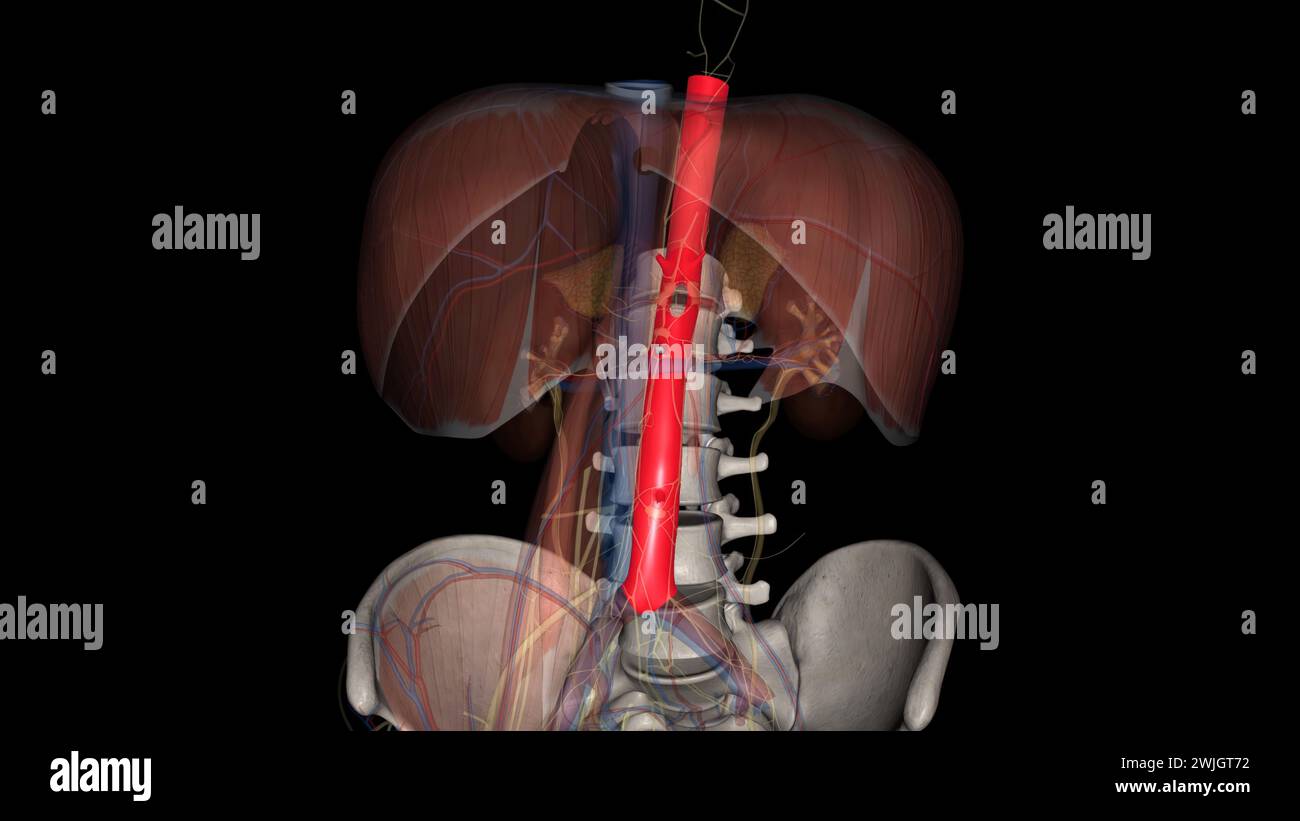 An abdominal aortic aneurysm is an enlarged area in the lower part of ...