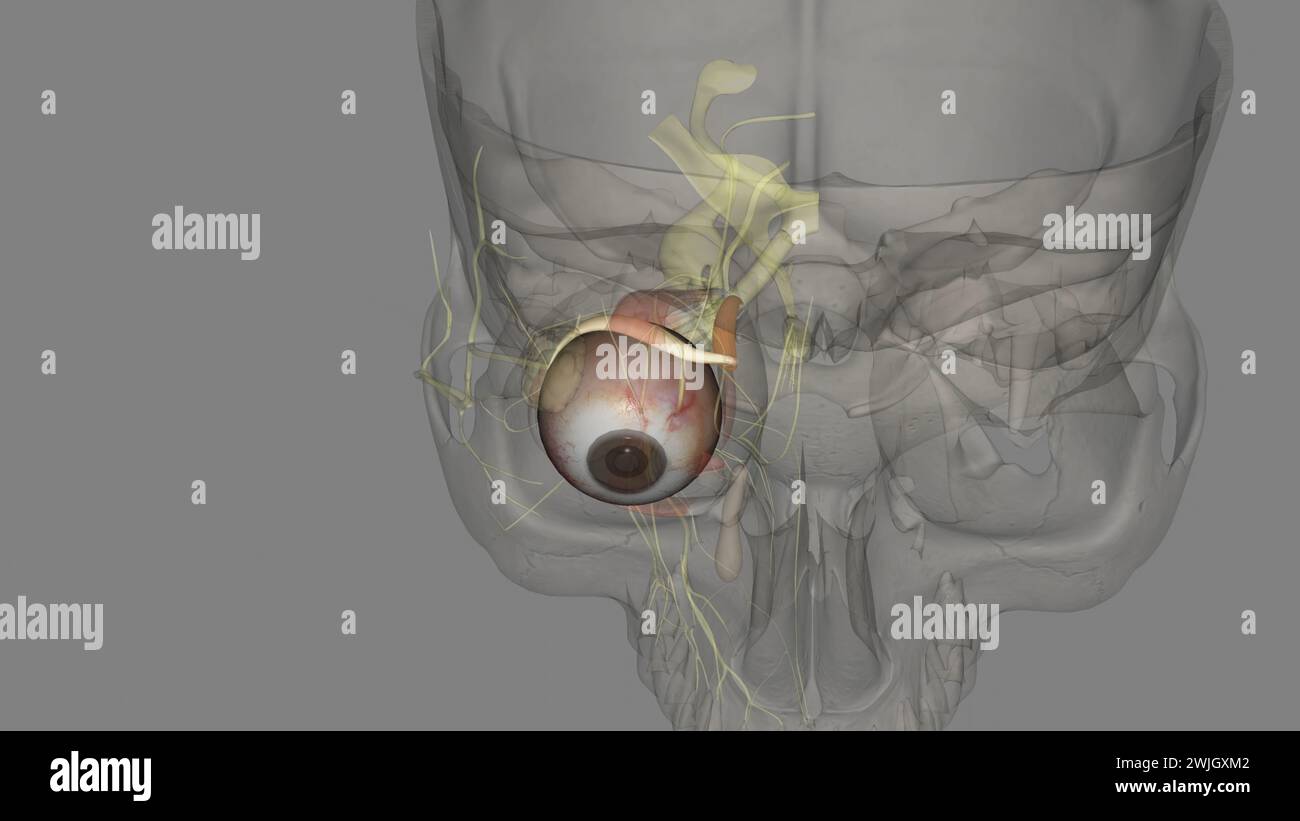 The superior oblique is one of the two noteworthy oblique extraocular