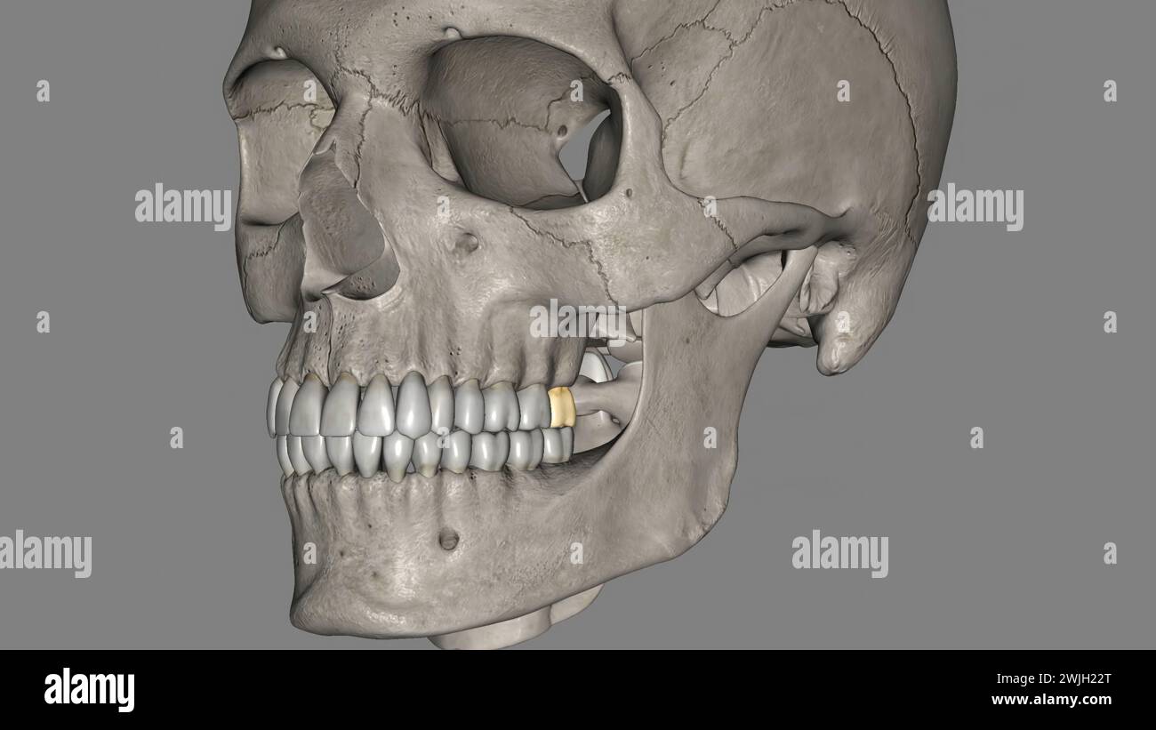 he maxillary third molar, is located very posteriorly on the dental ...