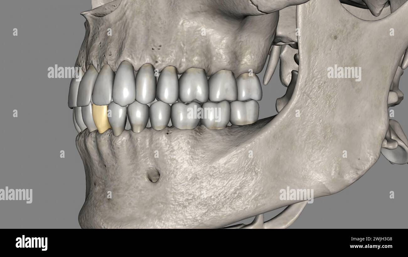 The mandibular lateral incisor is the tooth located distally from both ...