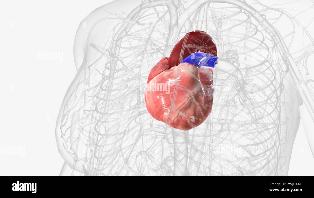 The heart is a fistsized organ that pumps blood throughout your body