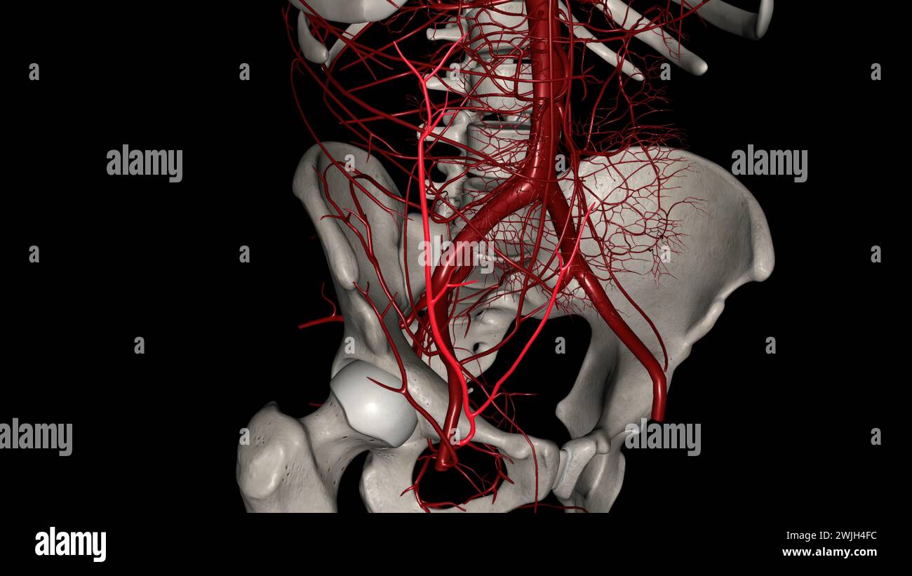 The superficial epigastric artery is a small branch of the femoral ...