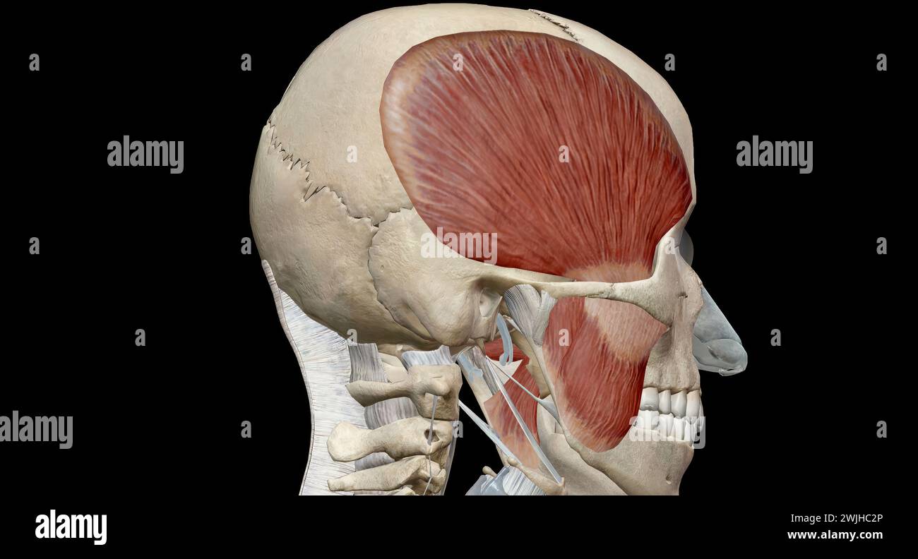 The muscles of mastication are a group of muscles that consist of the ...