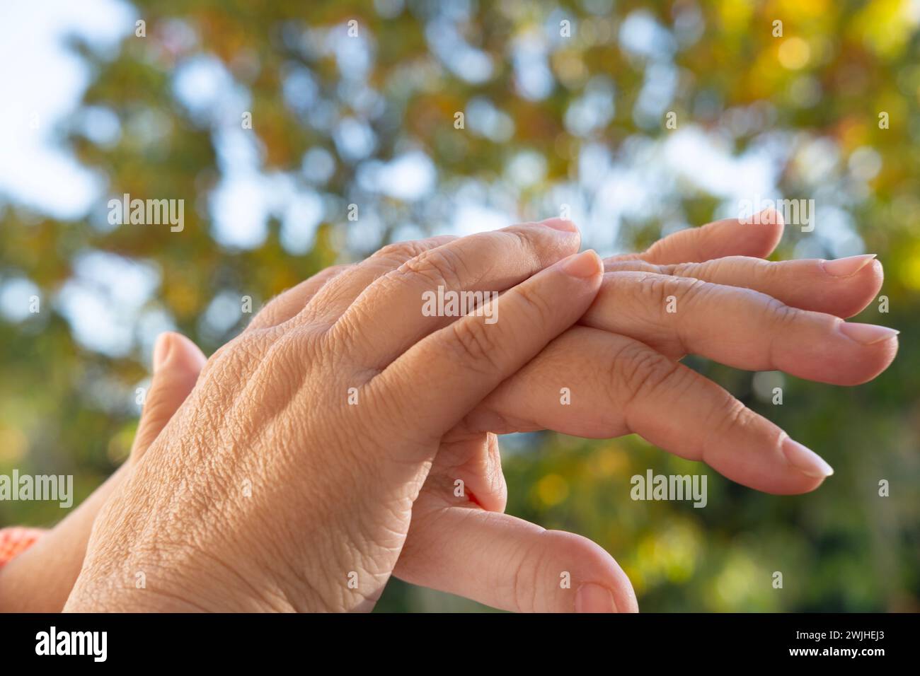 closeup female hands 55 years old with dry skin damage, applying moisturizer, concept beauty and skincare in second half life, treatment dermatologica Stock Photo