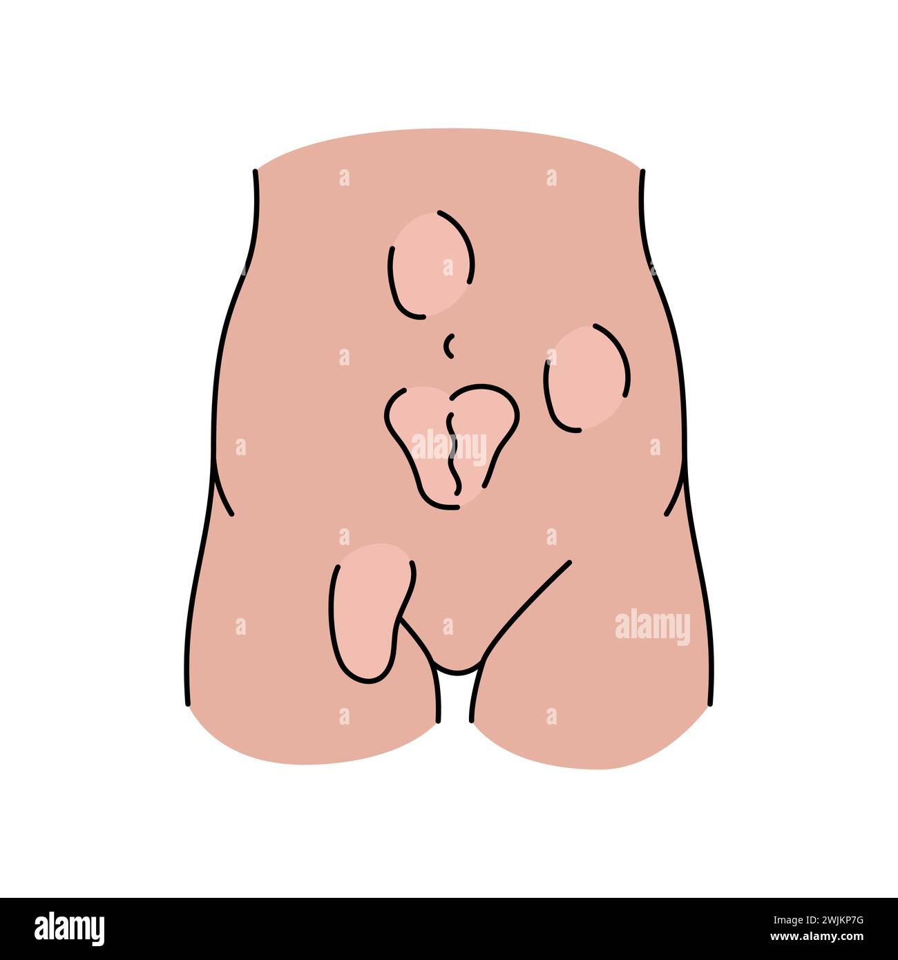 Hernias line icon. Vector isolated element. Editable stroke. Stock Vector
