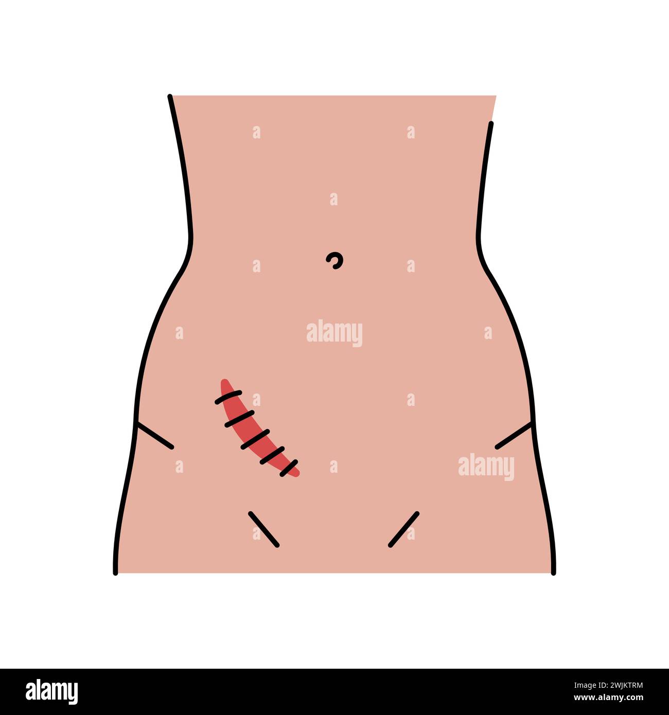 Battle incision line icon. Abdominal incisions. Vector isolated element ...