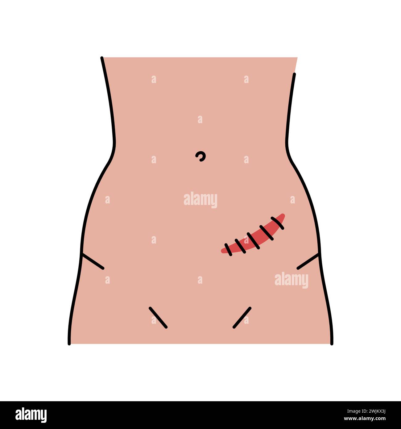 Rutherford morrison incision line icon. Abdominal incisions. Vector ...