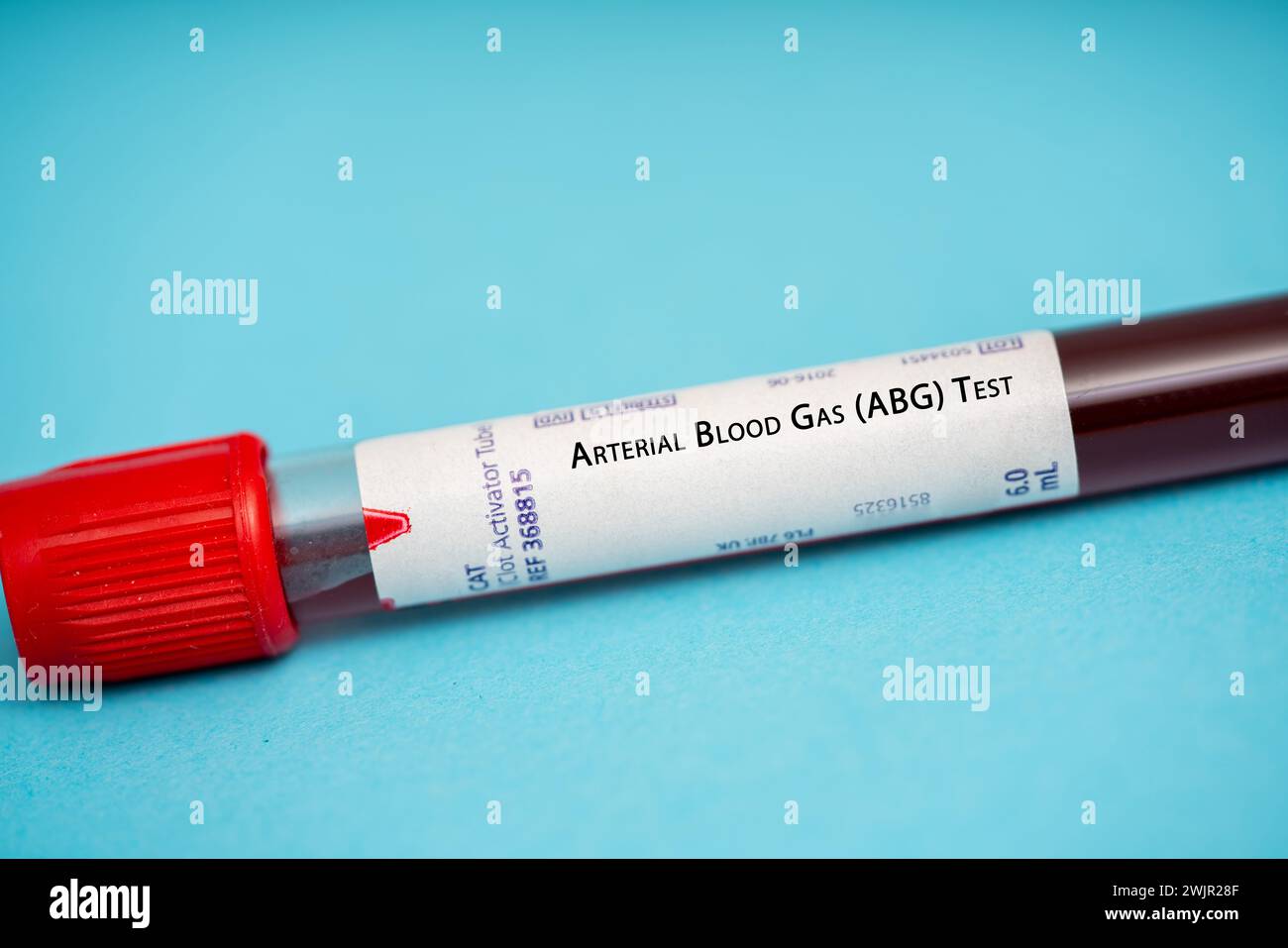 Arterial blood gas test Stock Photo