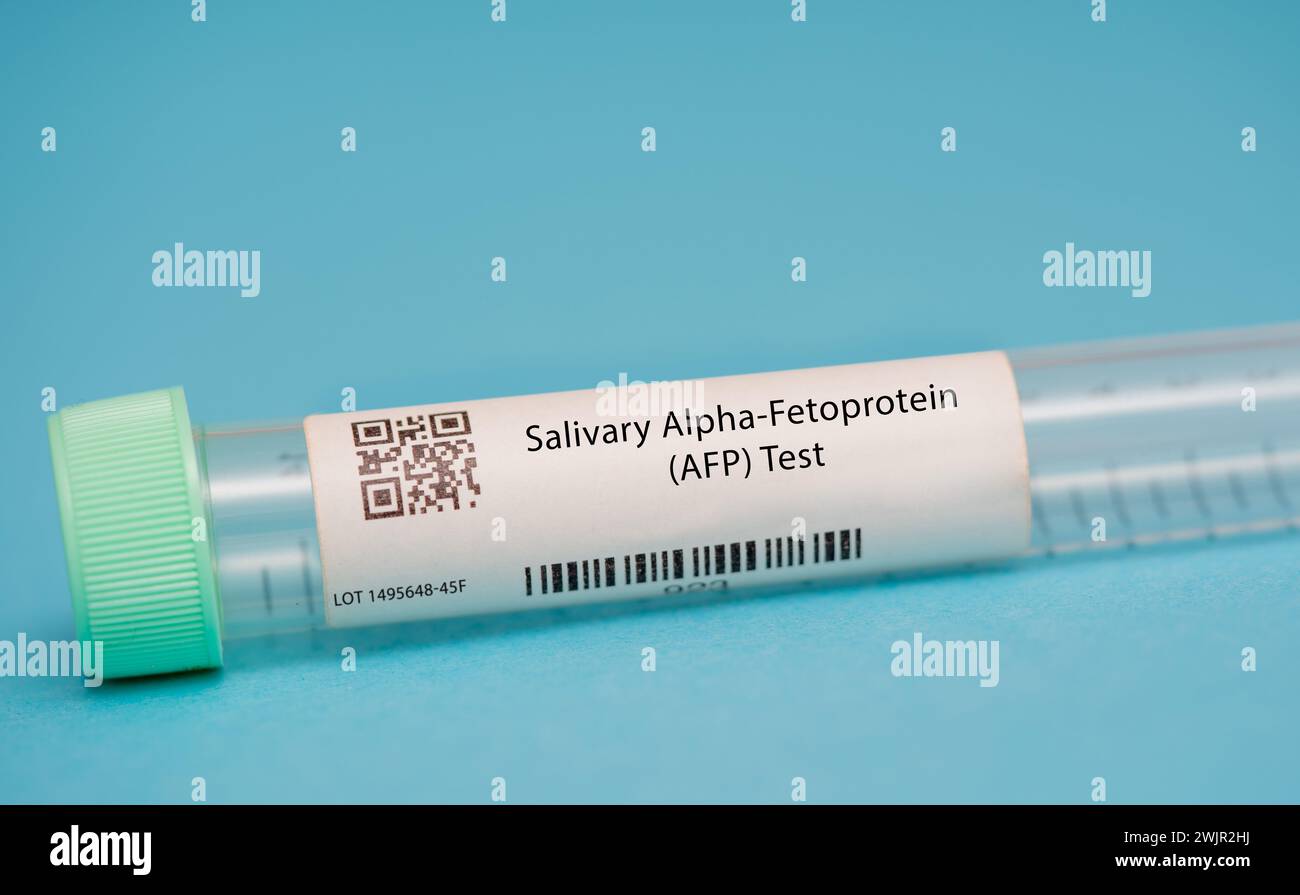 Salivary alphafetoprotein test Stock Photo Alamy