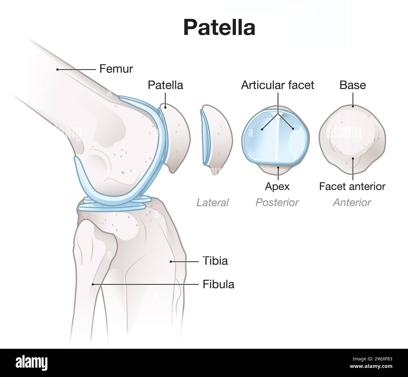 3D illustration showing bones and cartilage of a knee joint. Lateral
