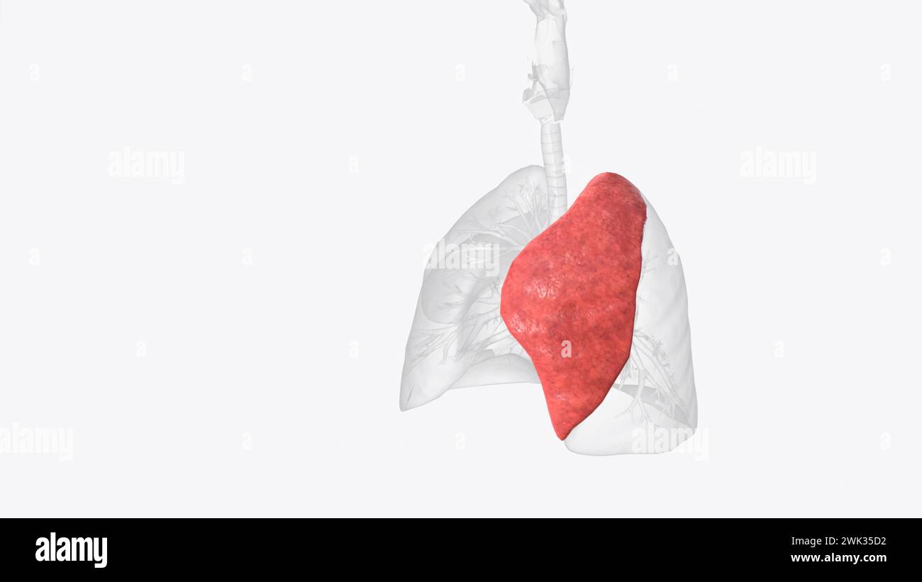 The superior lobe of the left lung is divided into five ...