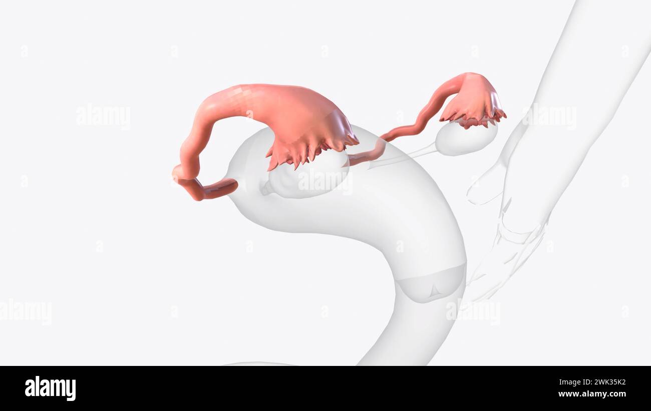 The fallopian tubes are bilateral conduits between the ovaries and the ...