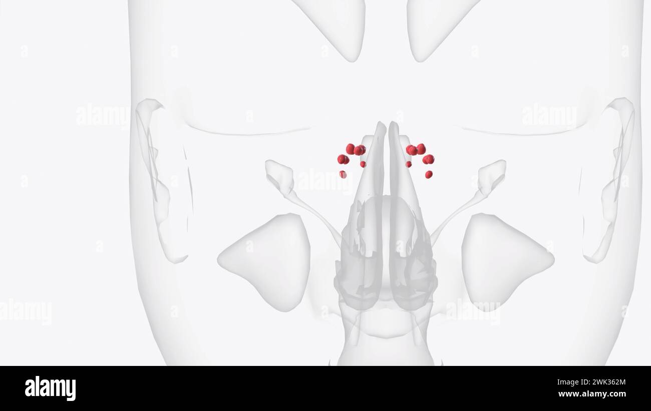 The ethmoid sinuses are located at the top of your nose (the bridge ...