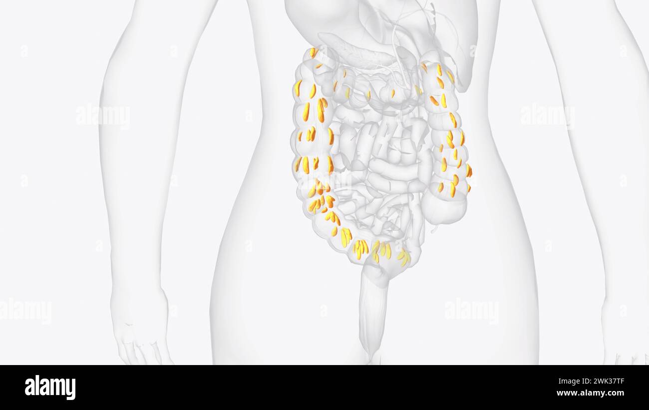 Epiploic appendages are normal outpouchings of peritoneal fat on the anti-mesenteric surface of the colon 3d illustration Stock Photo