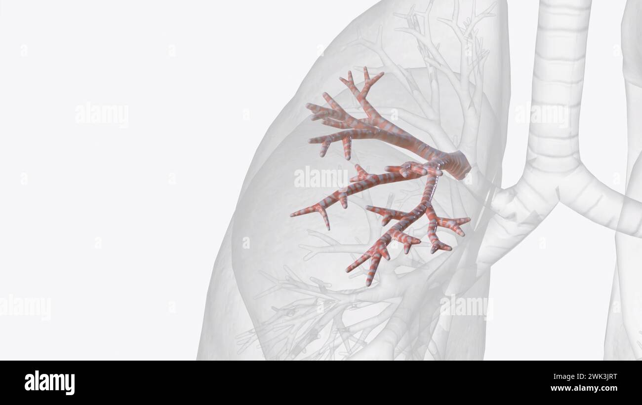 The anterior segmental bronchus of the right superior lobe bronchus ramifies to form the bronchial tree of the anterior bronchopulmonary segment of th Stock Photo