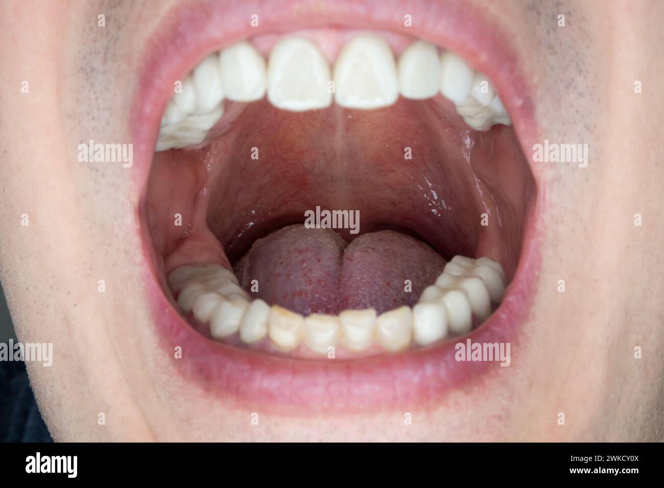 Caucasian male open oral cavity, close up shot. Stock Photo