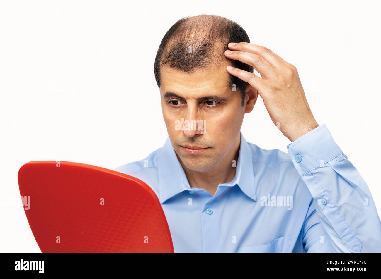 upset middle aged man with alopecia looking at mirror, hair loss concept Stock Photo