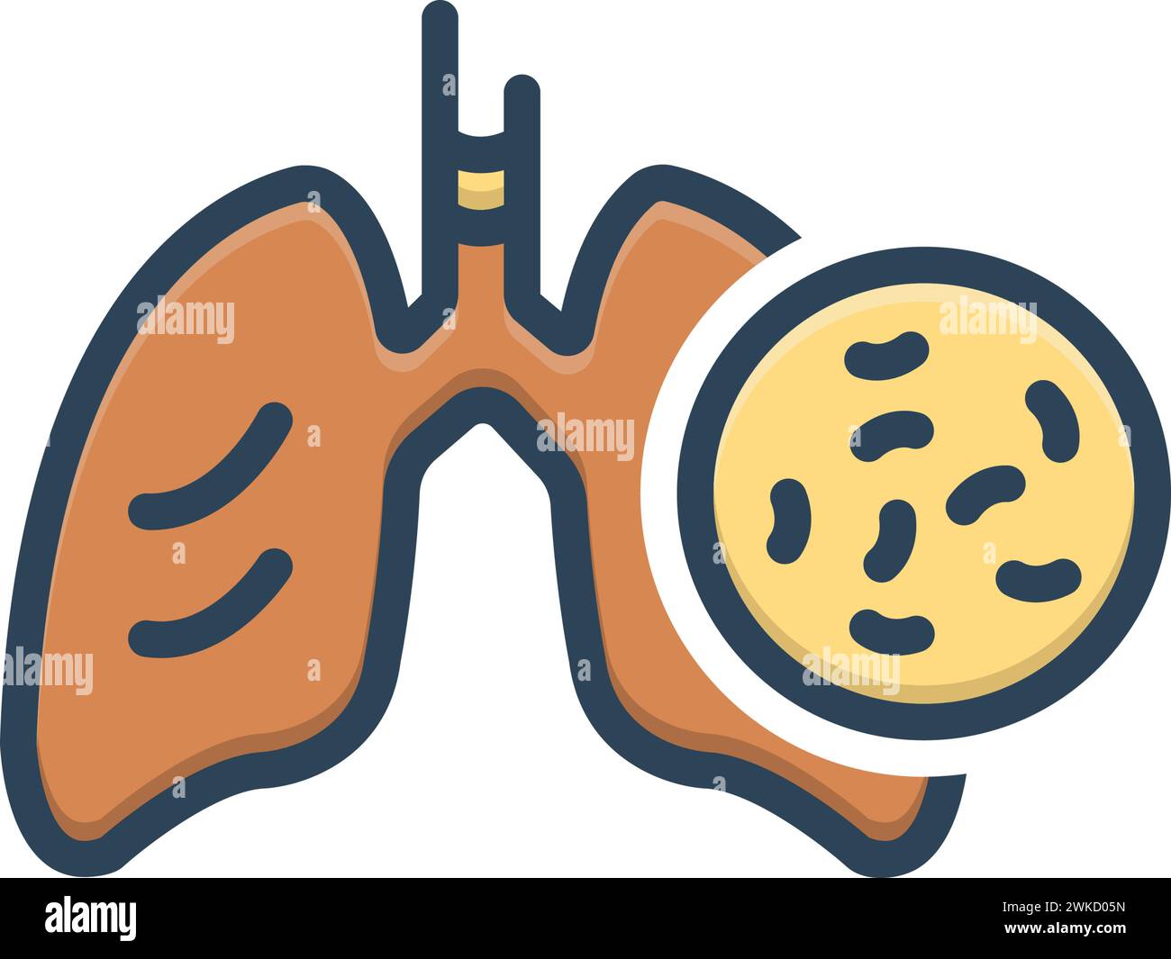 Tuberculosis Stock Vector Images - Alamy