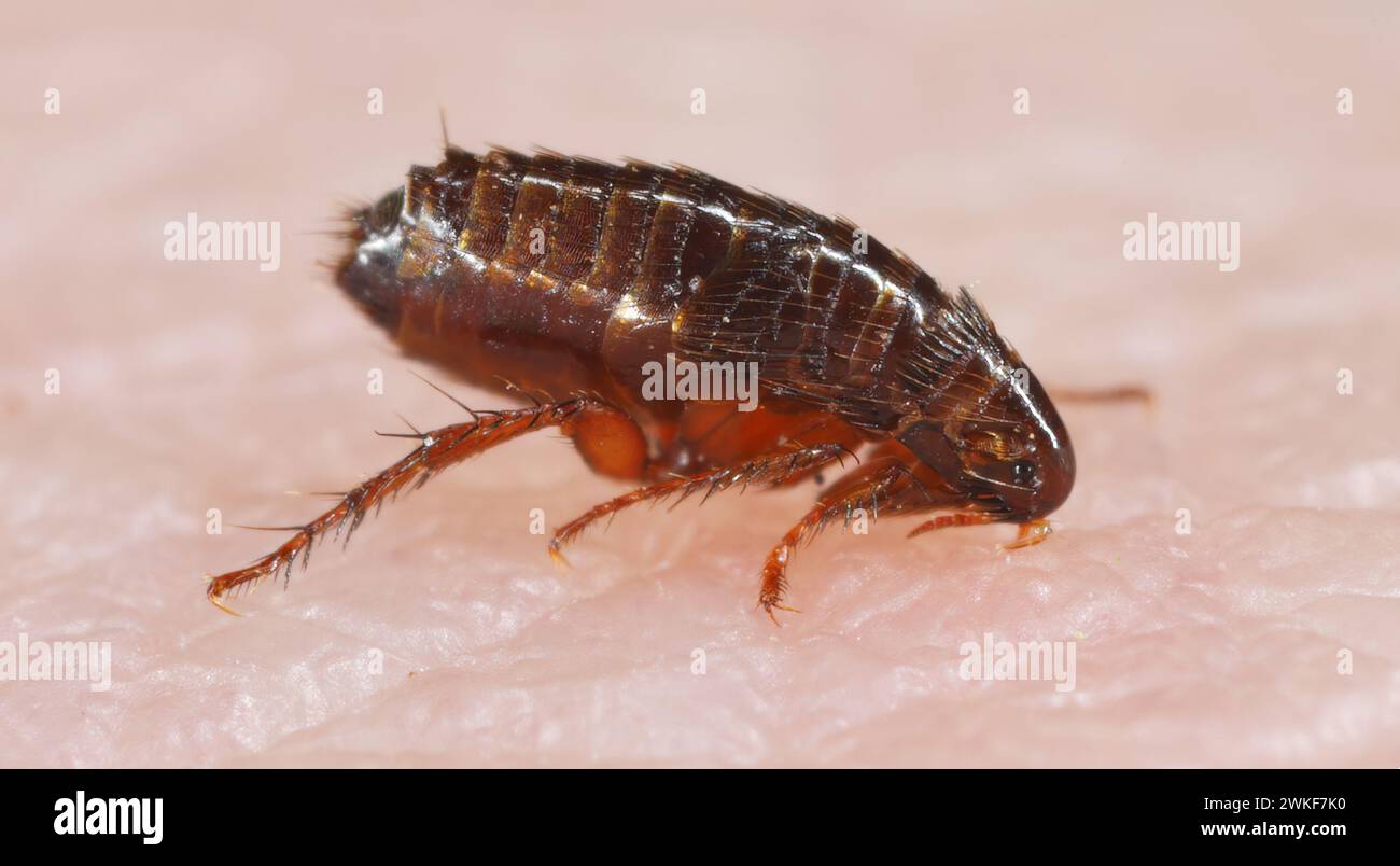 Flea. Insect biting and drinking blood on human skin Stock Photo - Alamy
