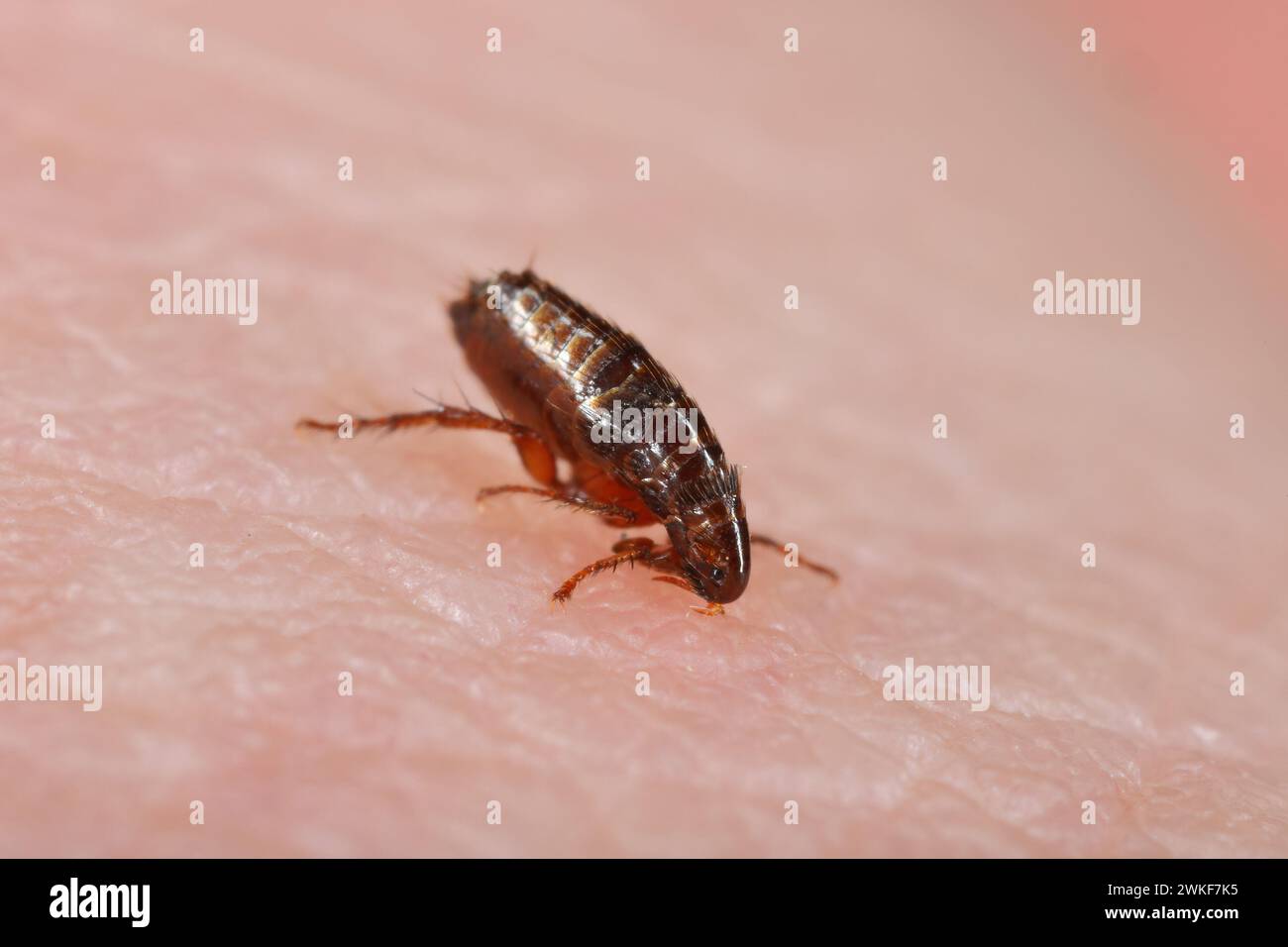 Flea. Insect biting and drinking blood on human skin. Stock Photo