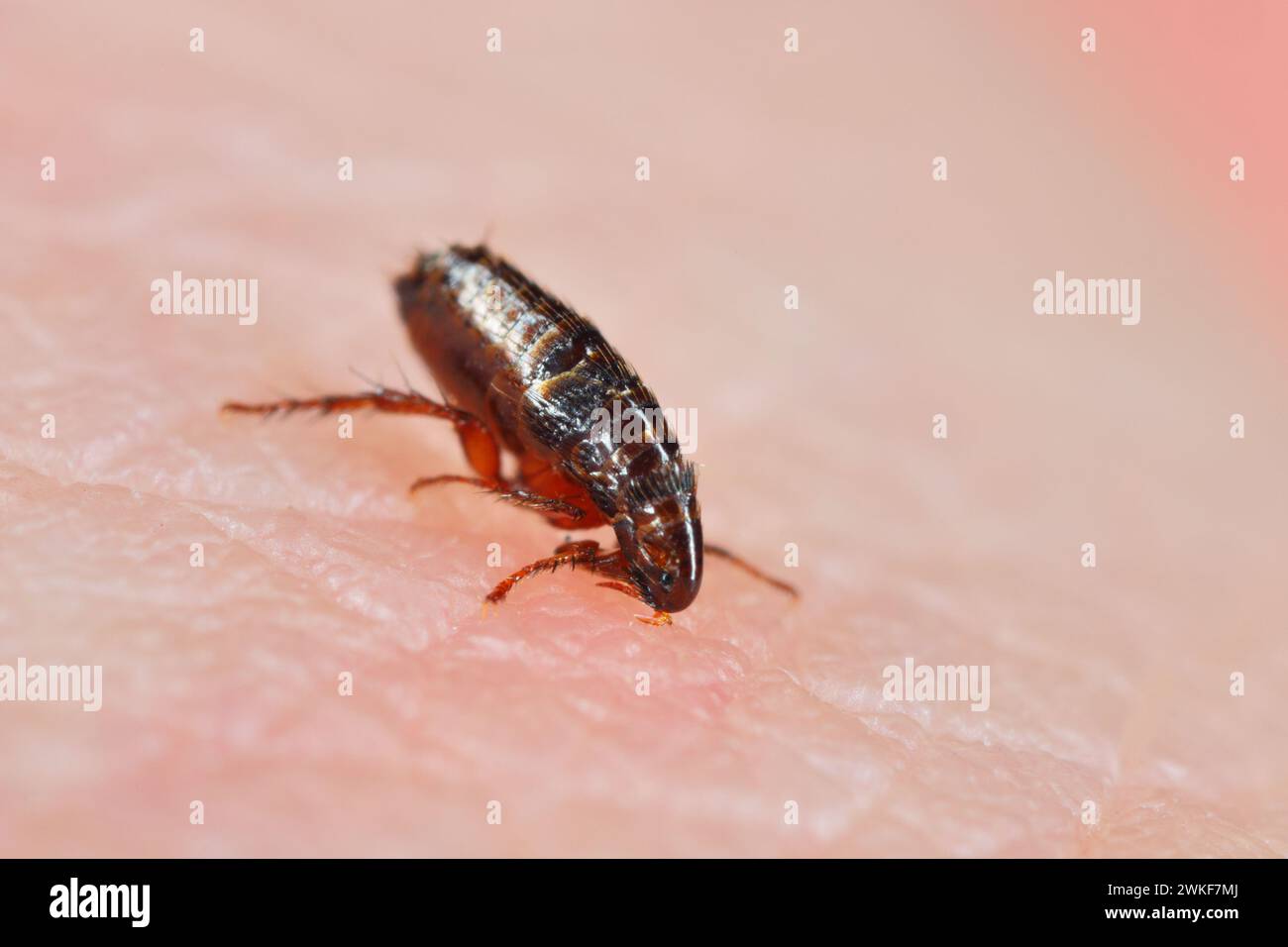 Flea. Insect biting and drinking blood on human skin. Stock Photo