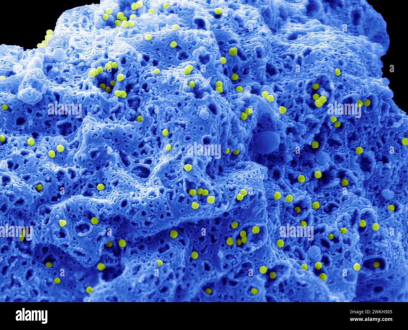 Adenovirus, SEM Stock Photo