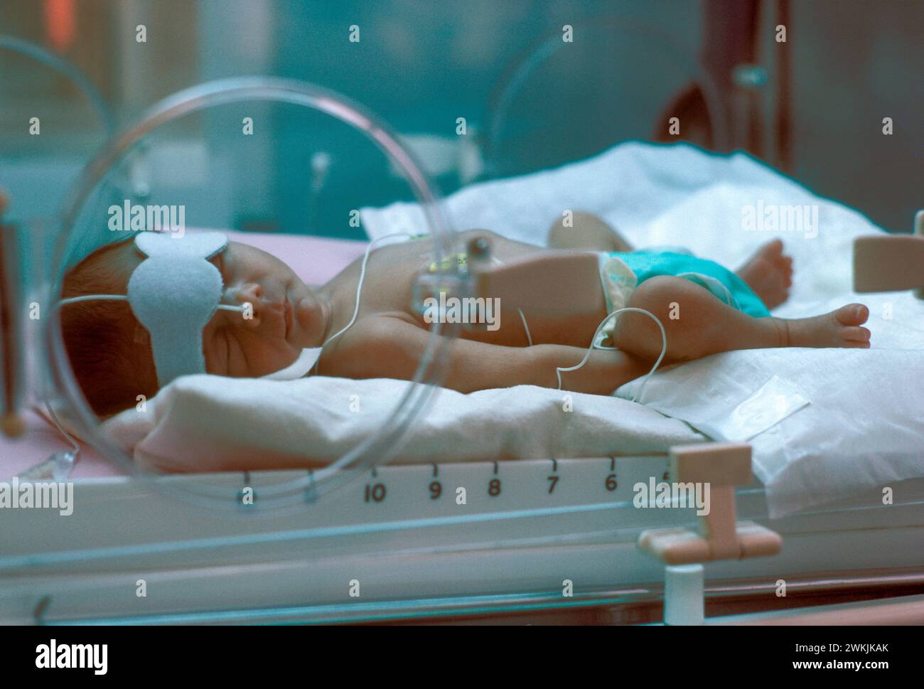 Low Birth Weight UK NHS. Premature Baby Unit 1980s Nottingham General Hospital, a new born premature baby in an incubator being monitored. Nottingham, Nottinghamshire, England circa 1985 HOMER SYKES Stock Photo