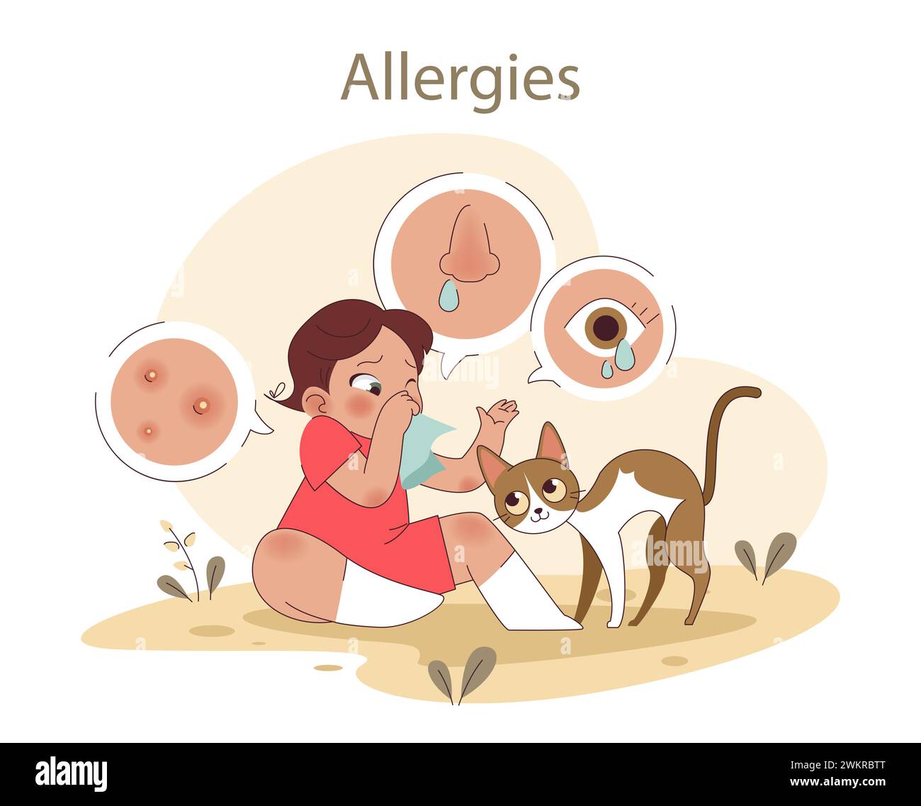Allergies concept. A child experiences common symptoms around a cat, depicting health challenges in pet interactions. Flat vector illustration Stock Vector