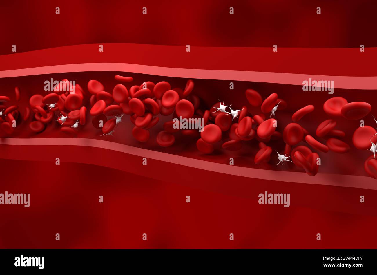 Reduced platelet (thrombocytes) count in Immune thrombocytopenic purpura (ITP) - isometric view 3d illustration Stock Photo