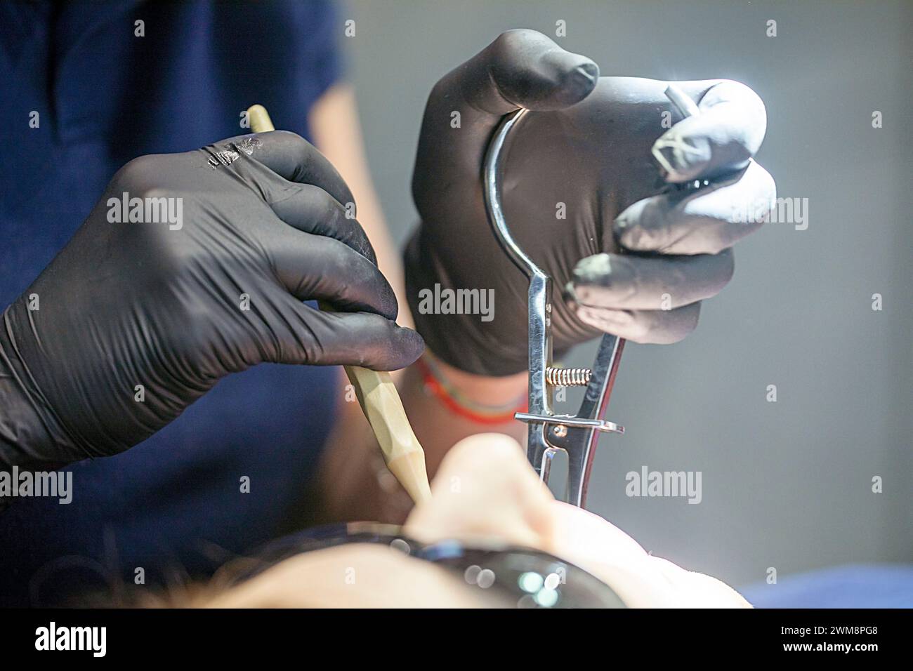 Stapler Tooth fix the staples between the teeth with a special dental instrument ...