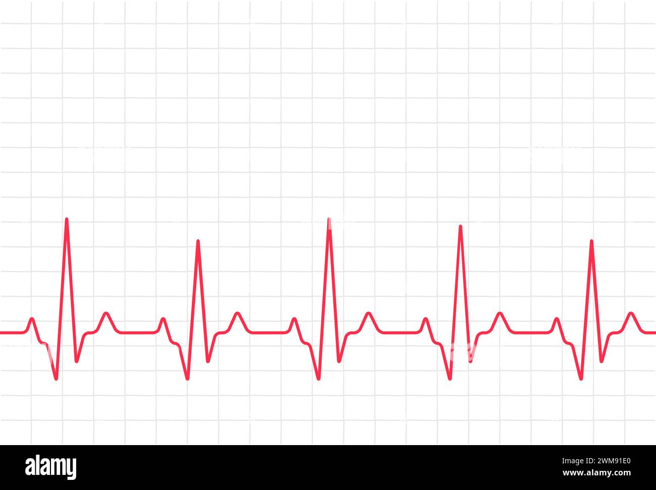 ECG heartbeat monitor, cardiogram heart pulse line wave. Electrocardiogram medical background Stock Vector