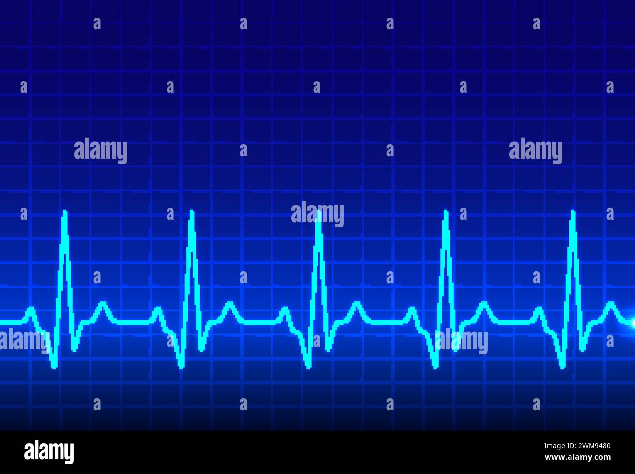 ECG heartbeat monitor, cardiogram heart pulse line wave. Electrocardiogram medical background Stock Vector