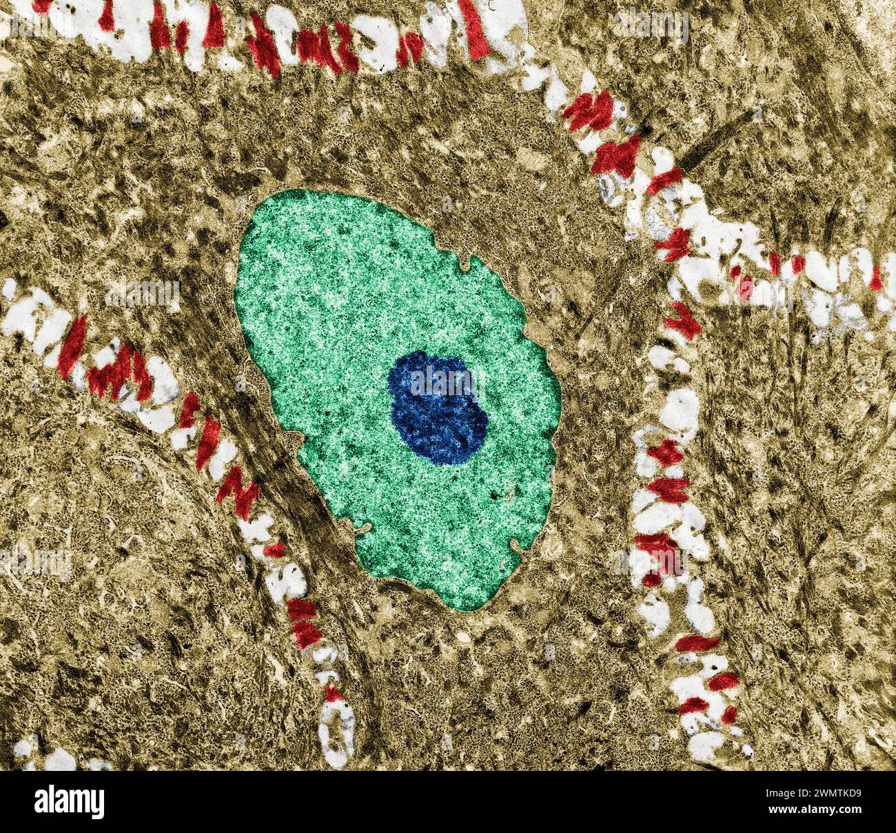 Desmosomes in epidermis, TEM Stock Photo - Alamy