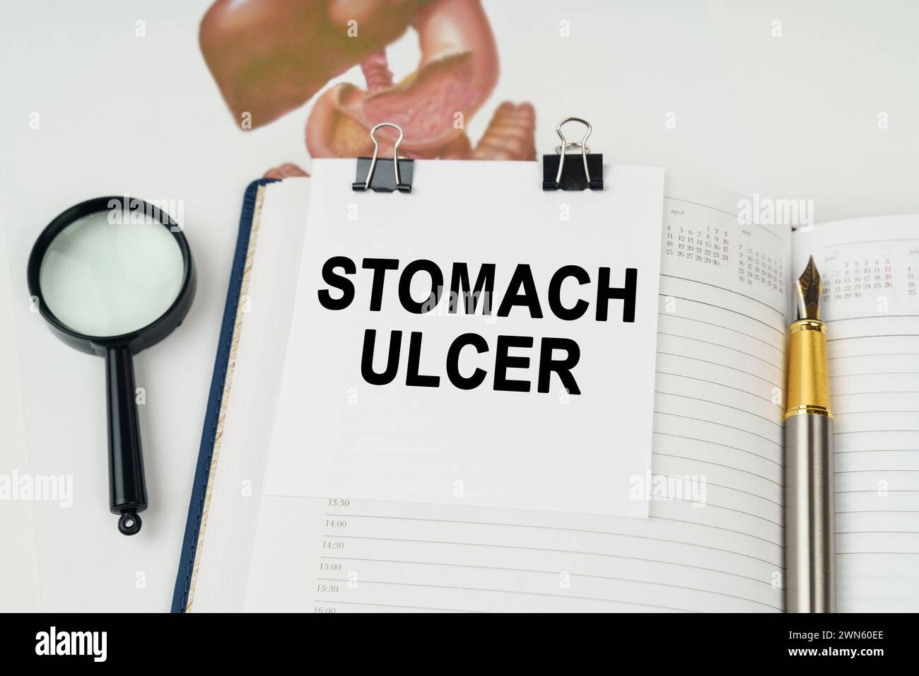 Medical concept. On the table there is a magnifying glass and a notepad with the inscription - Stomach ulcer Stock Photo