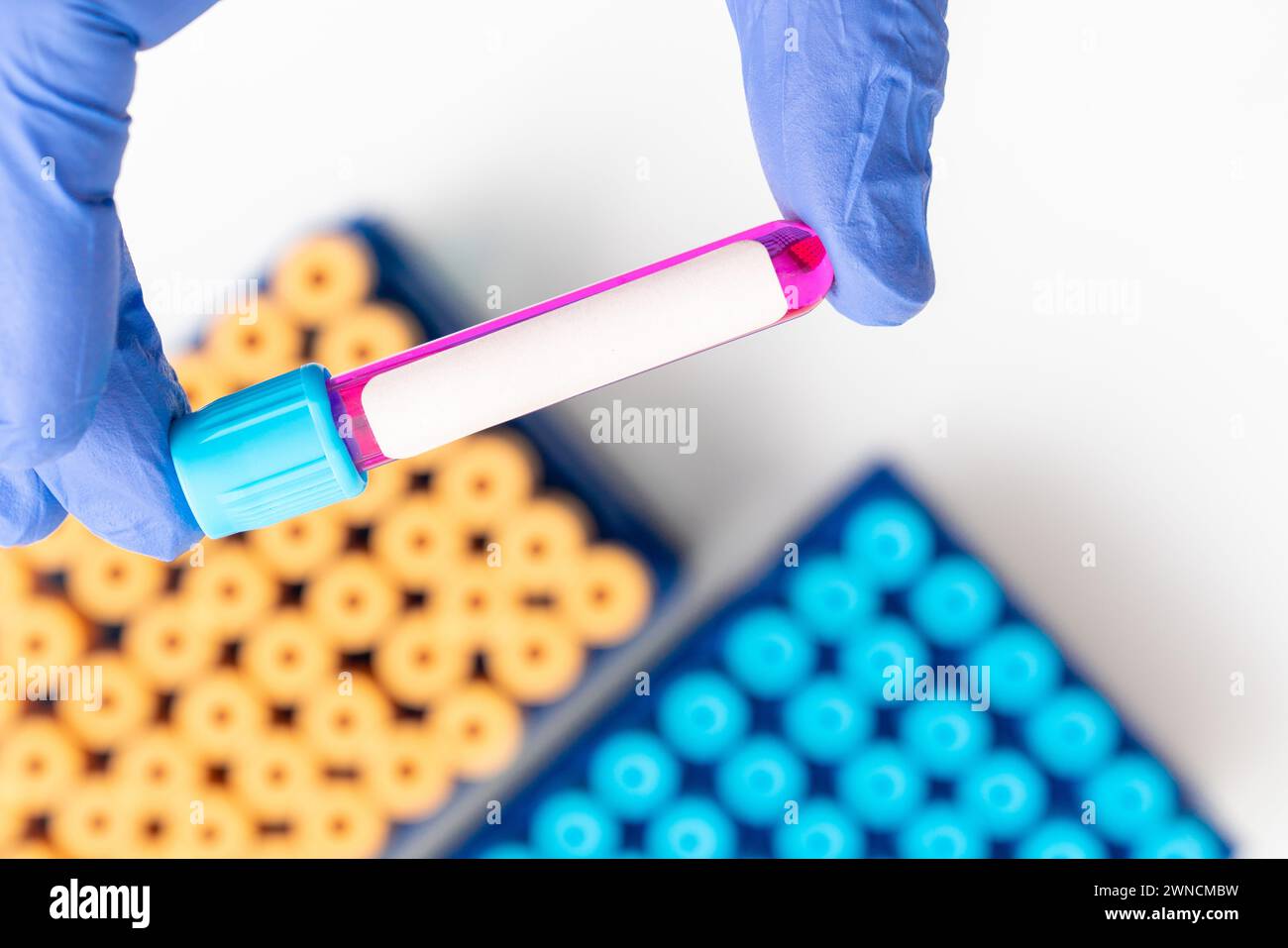 Medical test tube with blood sample Stock Photo - Alamy