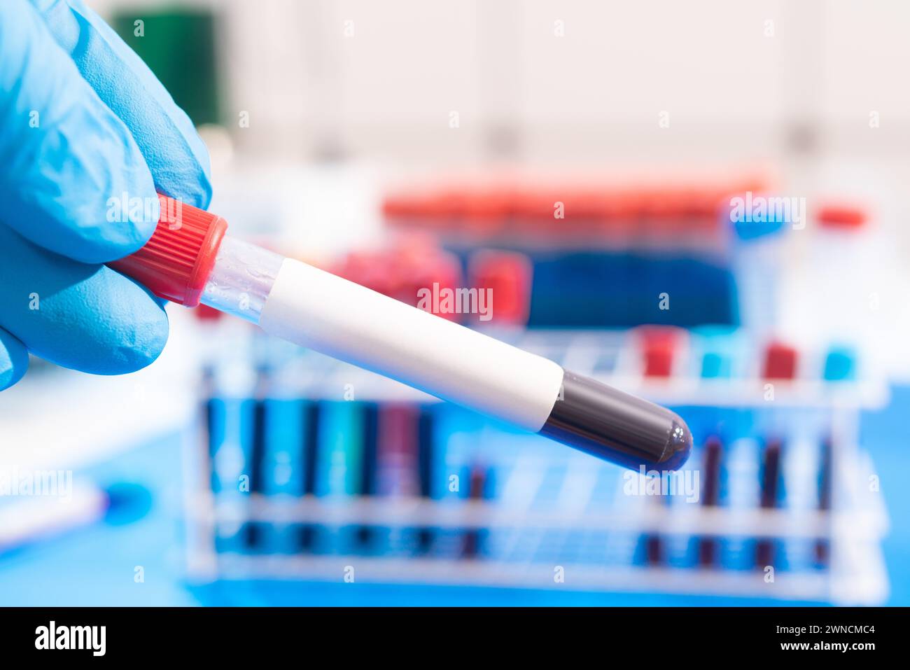 Medical test tube with blood sample Stock Photo