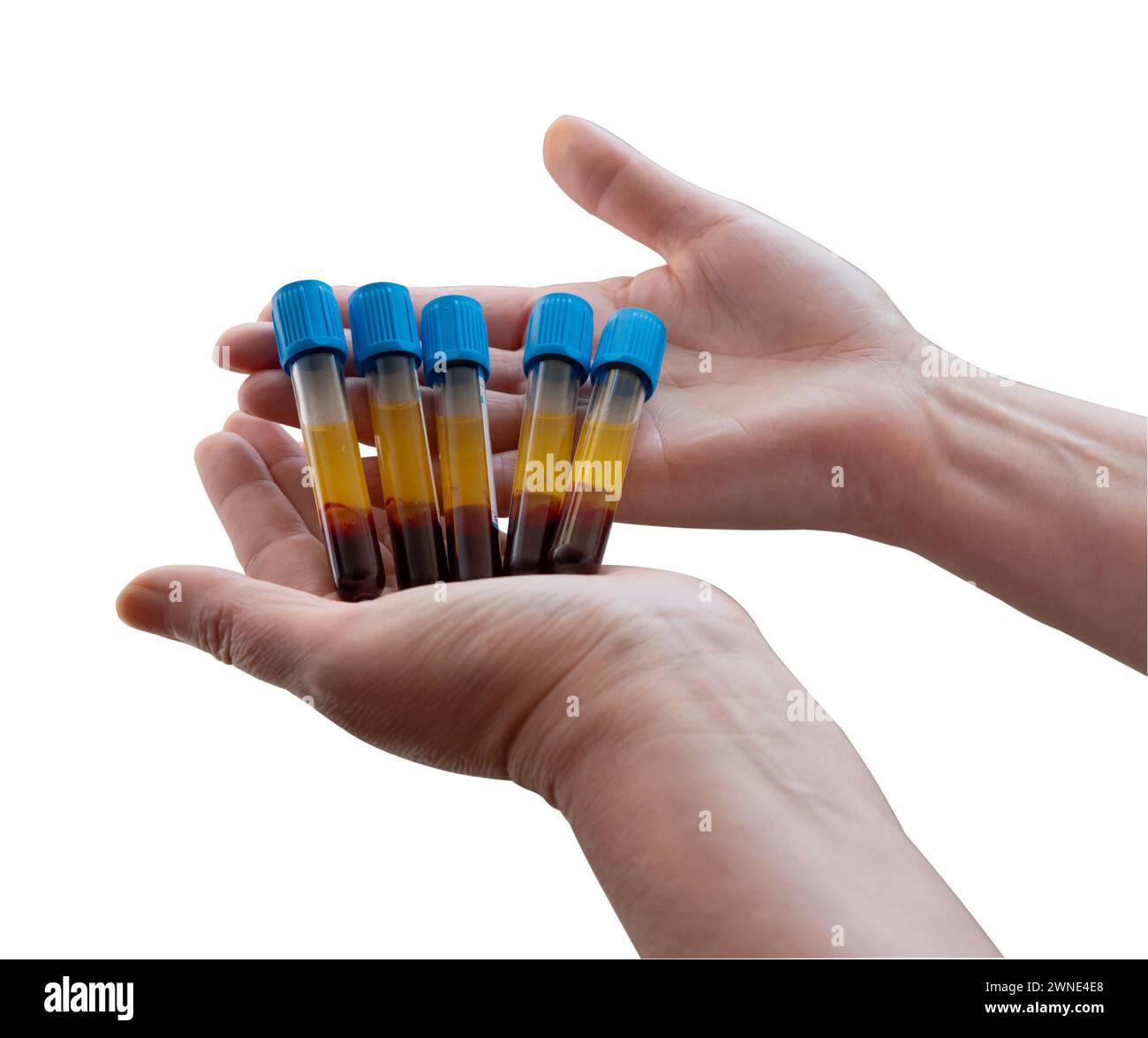Manos de mujer sujetando tubos con muestras de sangre con fondo blanco o aislado del fondo. Sanidad y salud. Stock Photo