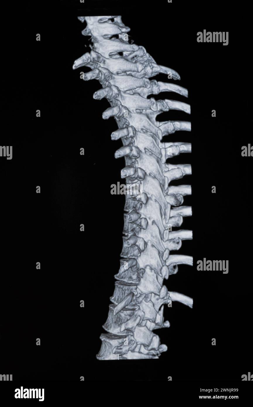Mri images hi-res stock photography and images - Alamy
