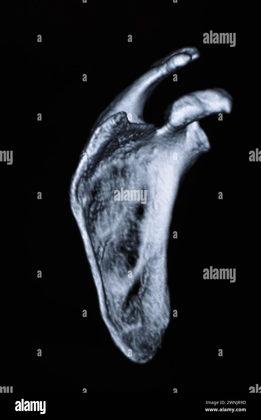 Human bone CT images Stock Photo - Alamy